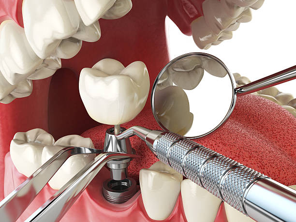 Best Weekend Emergency Dentist in North Webster, IN