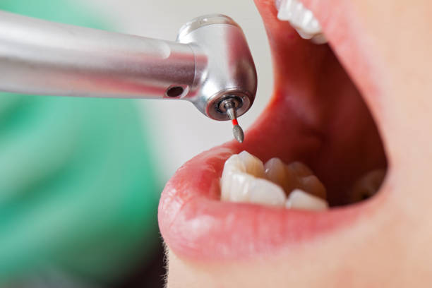Best Emergency Cosmetic Dentistry in North Webster, IN